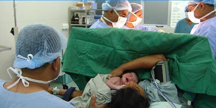 Il team medico in sala operatoria esegue un taglio cesareo