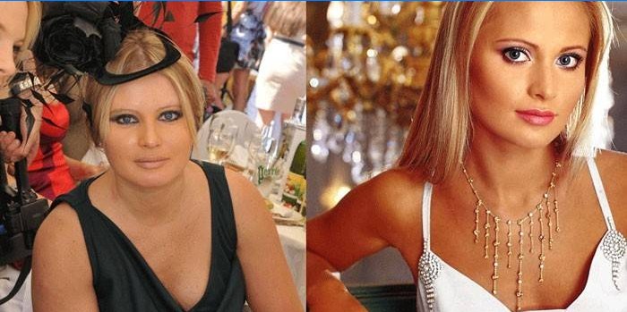 Dana Borisova prima e dopo aver perso peso