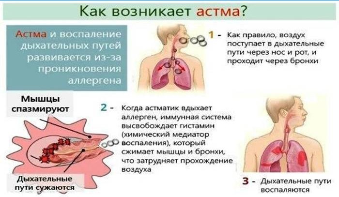 Come si verifica l'asma?